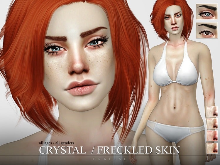 Crystal Freckles