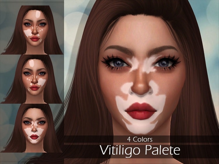 LMCS Vitiligo Palette