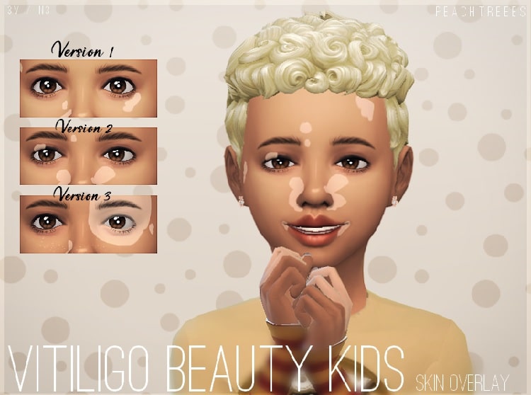 Vitiligo Beauty Skin Overlay for Kids N3