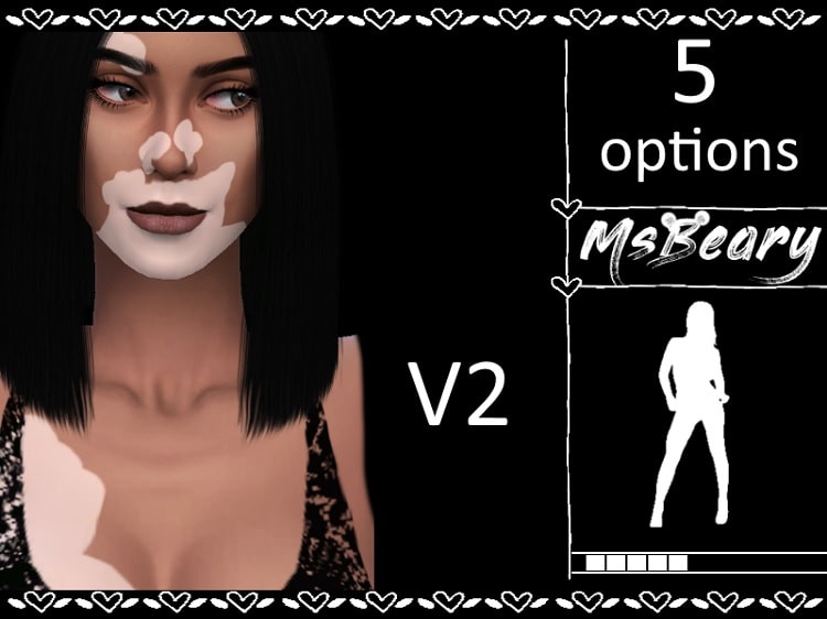 Vitiligo Skin V2 by MsBeary