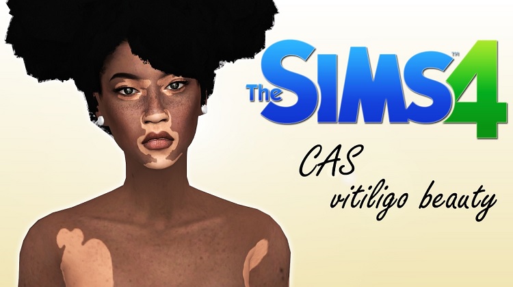 Sims 4 Vitiligo Skin CC & Mods