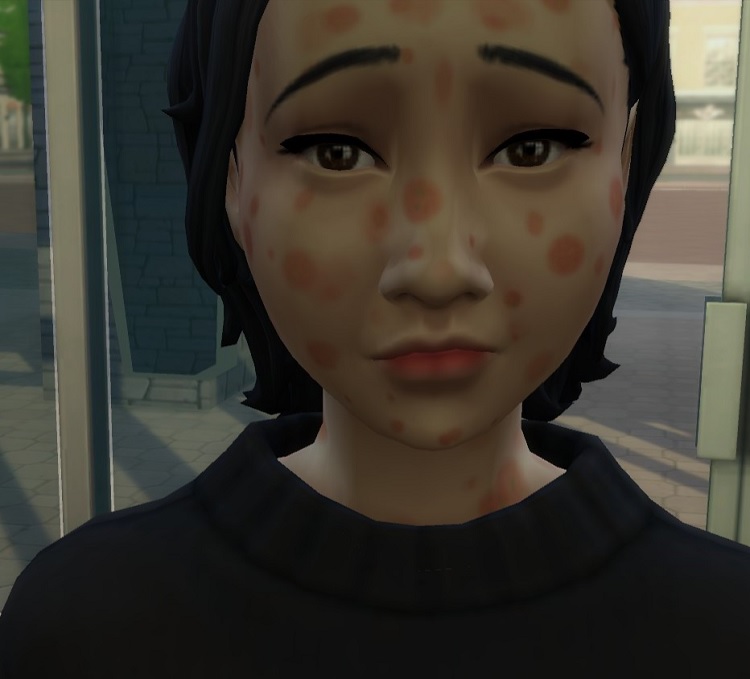 Rashes Sims 4