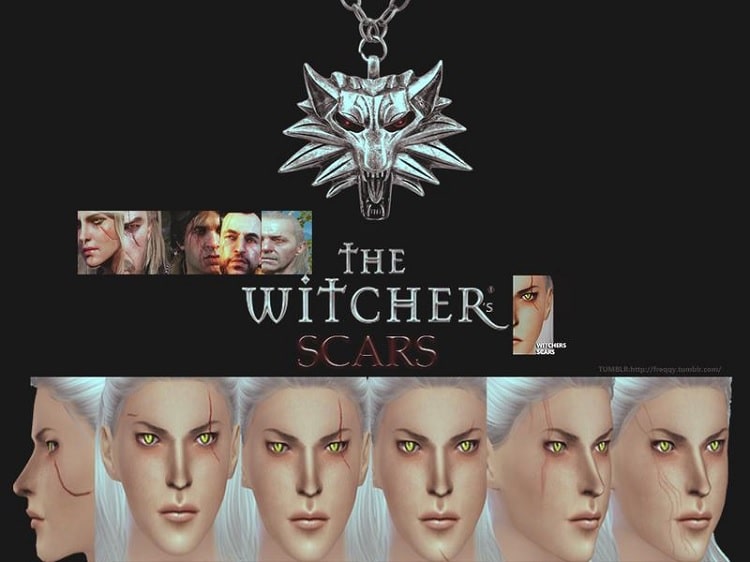 The Witcher's eye scar